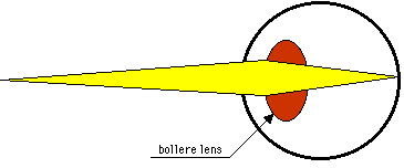 Tekening van normaal ziend oog op korte afstand